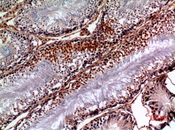 NTE rabbit pAb Antibody