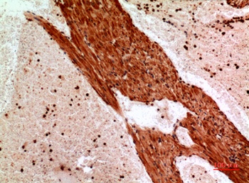 Angptl1 rabbit pAb Antibody