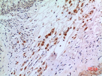 IFN-αR2 rabbit pAb Antibody