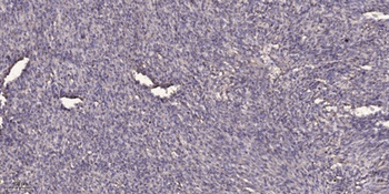 SCYL1BP1 rabbit pAb Antibody