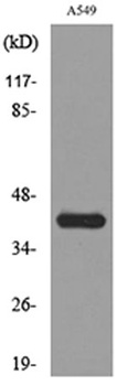 L-Selectin rabbit pAb Antibody