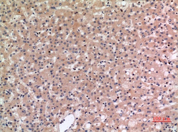 NTCP rabbit pAb Antibody
