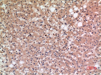 NTCP rabbit pAb Antibody