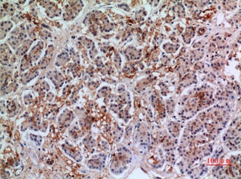 Annexin VII rabbit pAb Antibody
