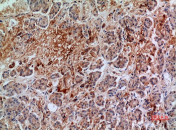 Annexin VII rabbit pAb Antibody