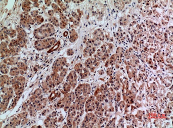 Annexin VII rabbit pAb Antibody