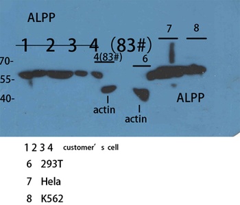 ALPP/ALPPL2 rabbit pAb Antibody