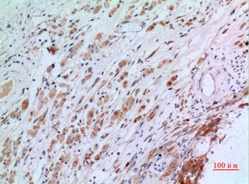 CGREF1 rabbit pAb Antibody