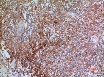 CGREF1 rabbit pAb Antibody