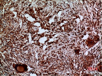 Laminin γ-2 rabbit pAb Antibody
