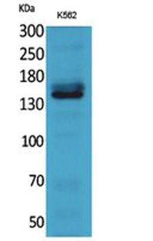 RFC1 rabbit pAb Antibody