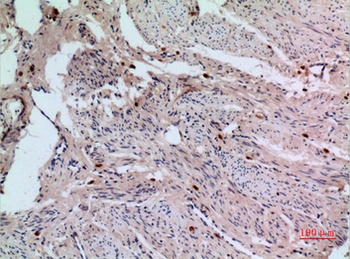 RFC1 rabbit pAb Antibody