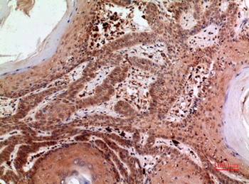 RFC1 rabbit pAb Antibody