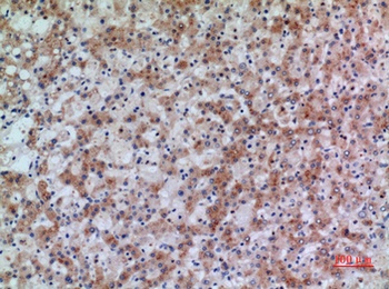 17β-HSD4 rabbit pAb Antibody