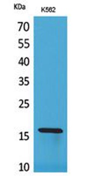 CRBP II rabbit pAb Antibody