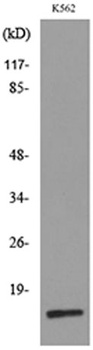 CRBP II rabbit pAb Antibody