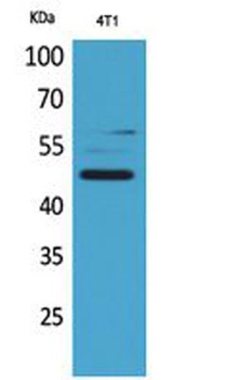 AACT rabbit pAb Antibody