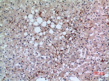 CD42b rabbit pAb Antibody