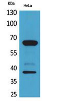 DNAM-1 rabbit pAb Antibody