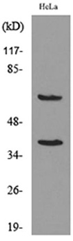 DNAM-1 rabbit pAb Antibody