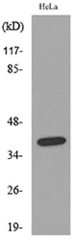 CD158b2/j rabbit pAb Antibody
