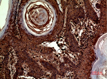 Inhibin β-A rabbit pAb Antibody