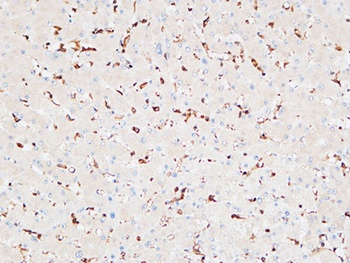 Inhibin β-A rabbit pAb Antibody