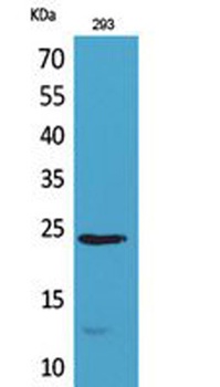 MDA-7 rabbit pAb Antibody