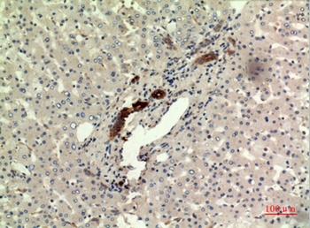 IFN-ω rabbit pAb Antibody