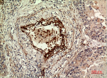 IDH1 rabbit pAb Antibody