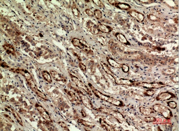 IDH1 rabbit pAb Antibody