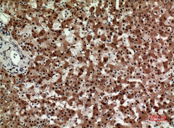Syntaxin 1 rabbit pAb Antibody