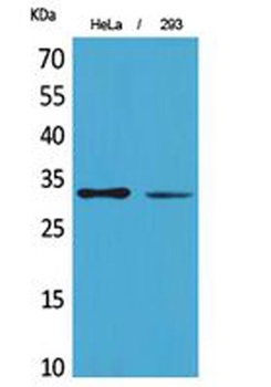 SDHB rabbit pAb Antibody