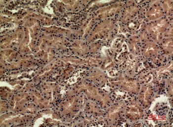 SDHB rabbit pAb Antibody