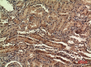 SDHB rabbit pAb Antibody