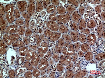 Neuropilin rabbit pAb Antibody