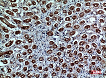 Neuropilin rabbit pAb Antibody