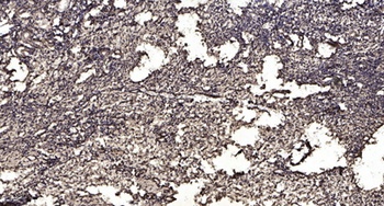 SNRPN rabbit pAb Antibody