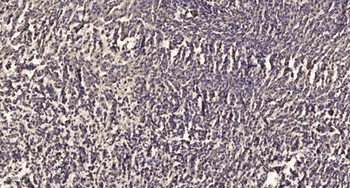 Integrin β2 rabbit pAb Antibody