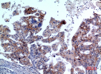 IL-1RII rabbit pAb Antibody