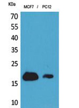 CD225 rabbit pAb Antibody