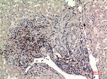 CD225 rabbit pAb Antibody