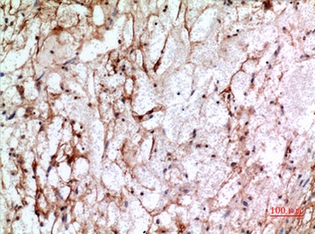 CD225 rabbit pAb Antibody