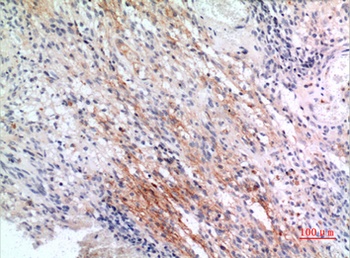 CD225 rabbit pAb Antibody