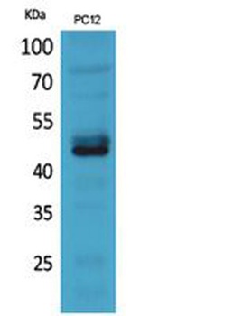 NKp44 rabbit pAb Antibody