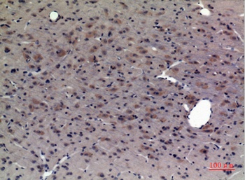 CRF-RI rabbit pAb Antibody