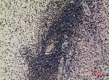 SAMHD1 rabbit pAb Antibody