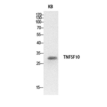 TRAIL rabbit pAb Antibody