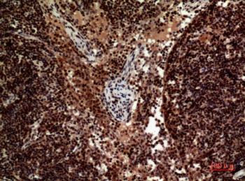 TRAIL rabbit pAb Antibody