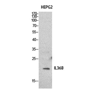 IL-1F8 rabbit pAb Antibody